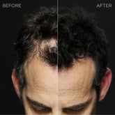 Toppik Hair Building Fibers and Thinning DARK BROWN 27.5g Anwar Store